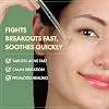 TOSOWOONG Madagascar Centella 86% Ampoule with 860,048ppm Centella Asiatica, Soothing, Calming, Facial Serum for face, for All Skin Types, Korean Skin Care, 100ml, 3.38 fl.oz.