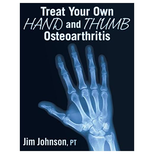 Treat Your Own Hand and Thumb Osteoarthritis