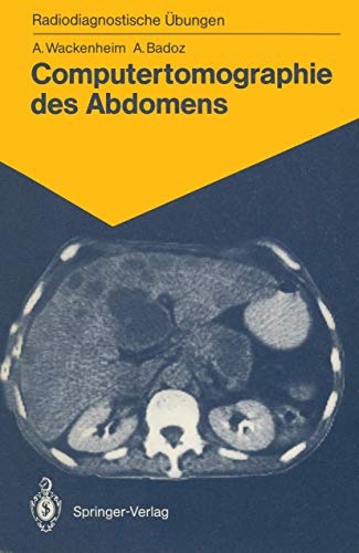 Computertomographie des Abdomens: 85 diagnostische Übungen für Studenten und praktische Radiologen (German Edition)