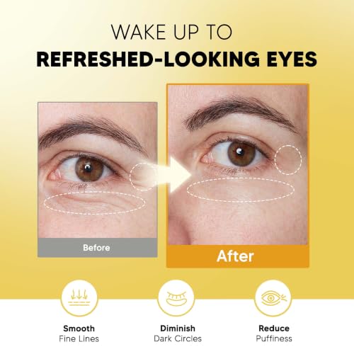 Image of Onespring 24K Gold Under Eye Patches, Peptide Collagen Eye Mask, 24 Pairs