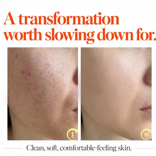 Image of Double Cleanser | Makeup & SPF Remover Facewash | Hydrated Skin