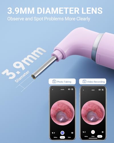 Image of ScopeAround Otoscope with Light, Ear Camera with Dual View, 720pHD WiFi Ear Scope with 6 LED Lights, 3.9mm Lens Otoscope Camera for Kids and Adults, Ear Scope Compatible w /iPhone and Android Pink