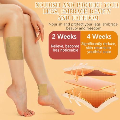 Image of KENASHII Turmeric Varicose Vein Patch - Natural Herbal Relief for Leg Pain, Swelling, Circulation & Spider Veins - Plant-Based Patches for Healthy Veins & Comfort - Reduces Acne Scars