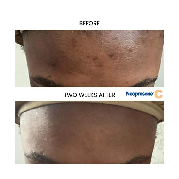 Neoprosone-Vitamin-C-Serum-for-Face-1-Fl-oz-30ml-For-Dark-Circle-Wrinkles-Dark-Spots-Hyperpigmentation-Treatment-with-Alpha-Arbutin-and-Castor-Oil Neoprosone, Vitamin C Serum for Face | 1 Fl oz / 30ml | Brightening Serum For Dark Circle, Wrinkles | with Alpha Arbutin and Castor Oil