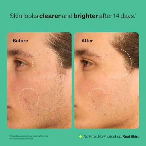 Peach Slices Snail Rescue Blemish Busting Toner (4.05 oz) — view 6