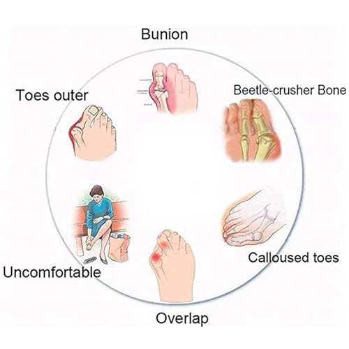 Ladies Summer Plantar Fasciitis Slippers,Comfy Foot Correction Womens Sandals For Hallux Valgus,Beach Flat Flip Flops With Arch Support3