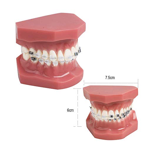 Model ortodontyczny zębów dentystycznych z metalowymi i ceramicznymi wspornikami modele demonstracyjne dla dentysty do komunikacji z pacjentami