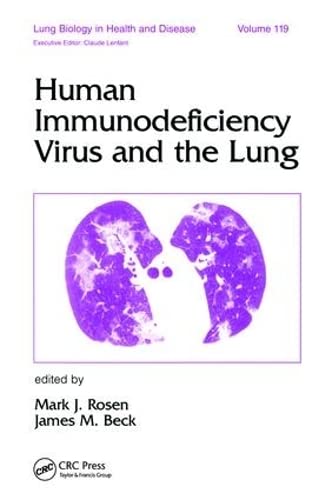 Human Immunodeficiency Virus and the Lung (Lung Biology in Health and Disease)