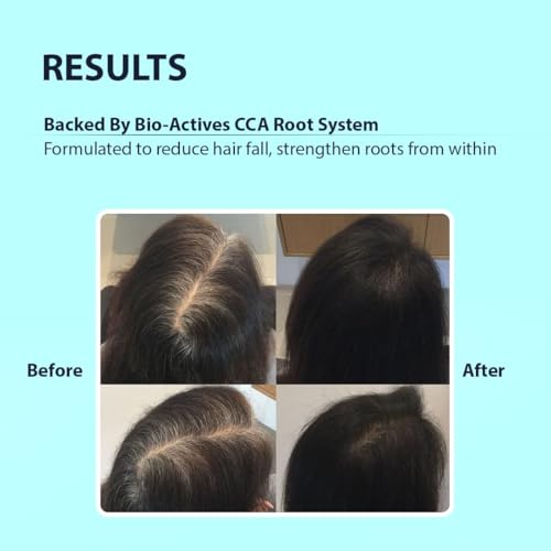 Image of Dermistry Caffeine Collagen Arginine Hair Fall Control Shampoo Strengthens Weak Roots Improves Hair Thickness Density & Reduces Breakage for Dry Frizzy Curly All Hair Types Men Women 200ml