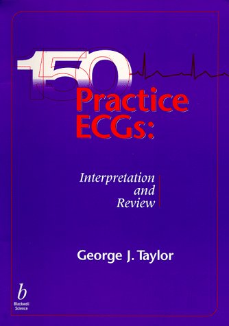 150 Practice ECGs: Interpretation and Board Review