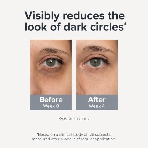 Under Eye Brightener Roller - Caffeine & Retinol Eye Serum for Dark Circles β image 5