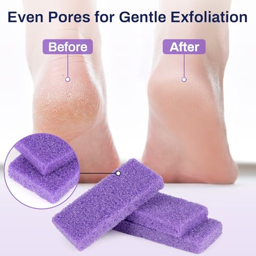 image for RAQEHO 20 Small Pumice Stone for Feet - 3.6 X 1.8 X 0.47 Inch Purple F