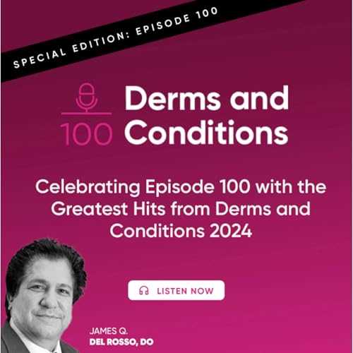Celebrating Episode 100 with the Greatest Hits from Derms and Conditions 2024 Podcast Por  arte de portada