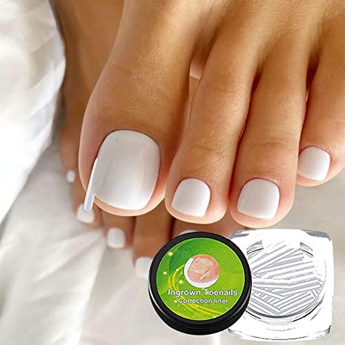 Ferramenta de unha encravada, remendo de correção de unha com levantador, Podólogo profissional corr