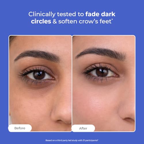 Image of Conscious Chemist Retinol Peptide Under Eye Cream With Soothing Massage Roller | Under Eye Roll On For Dark Circles, Fine Lines & Puffy Eyes | For Women & Men | 15 ml (Pack of 2)