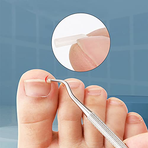 (30+2) Pack Ingrown Toenail Correction Treatment Kit, 30Pcs Ingrown Toenail Corrector Strips Brace Ingrown Toenail Pedicure Tool Toenail Correction Patch With 2Pcs Ingrown Toenail Lifter And File #TOP4