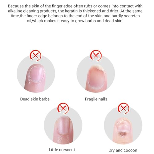 Nail Cuticle Oil, Nagelöl für Nagelhaut und Stärkere Nägel, Nagelpflegeöl Pflege für Hände und Füße, Nagelhautöl mit Pipette, Nail & Cuticle Oil, Nagelstärkungsöl (Orange, 15ml)