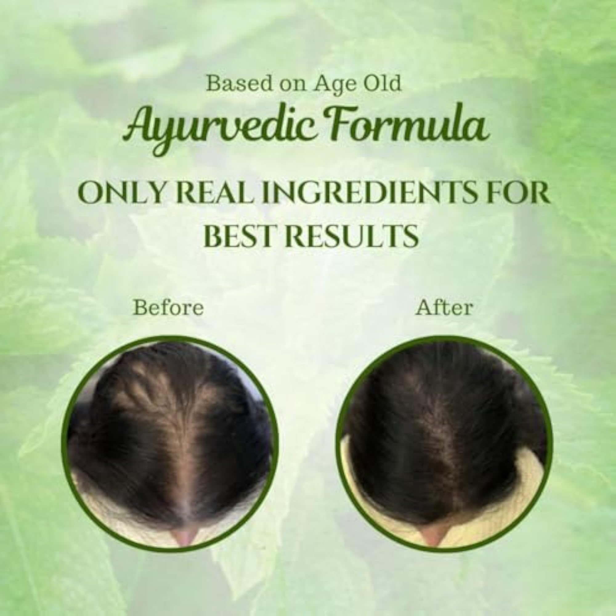 Ayurvedic Medicinal Anti Fall Oil, Natural Hair Treatment