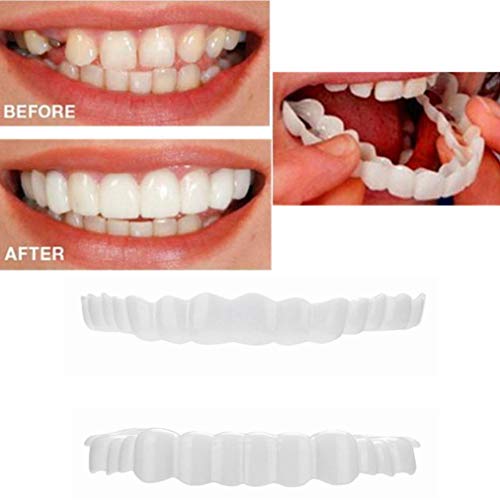 FLASHDOG 1 Set Top and Bottom Veneers Teeth, One Size Cosmetic Teeth Fit Flex Cosmetic Teeth Denture Teeth Veneer Whitening (1 Set Top and Bottom Veneers)