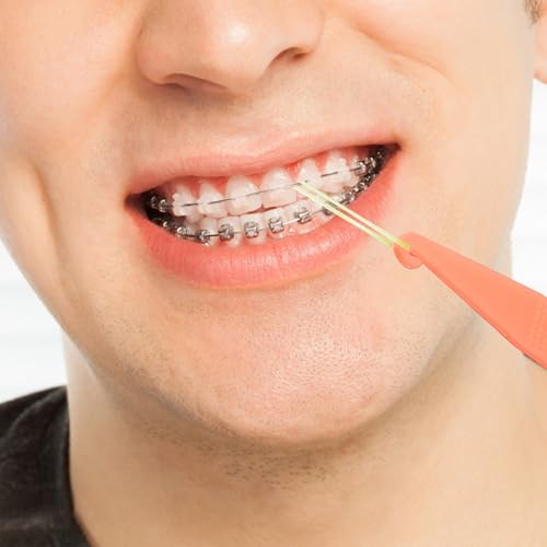 500 Stück Zahnspange Gummi, Kieferorthopädische Elastische, Orthodontic Latex Elastics, Mit 5 Stück Platzierer, Geeignet für Zahnspangen, Zahnlücken und Schiefe Zähne (Fuchs 1/4\)