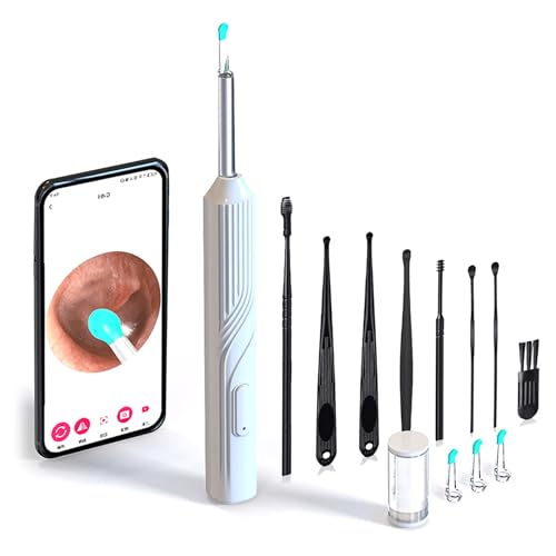  Jt ݂݂ J ~ Jt CJ ɍ׃Y E]@\ | J Type-C[d 6LEDCgt h ^ ʐ^ WIFIڑ iOS/Android/iPad@Ή q l N