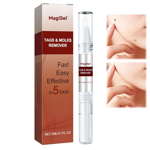 Haut-Tag-Entfernung Set, Entferner-Stift pen for...