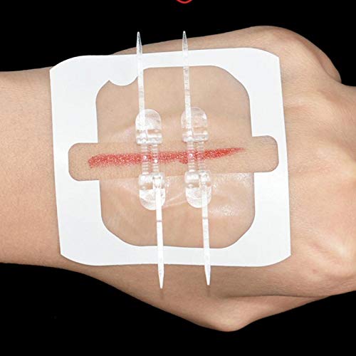 Clever Medical Design: ZipStitch, a DIY Non-Invasive Substitute for Stitches Based on Zip-Ties