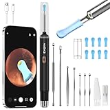 Earglow Otoscopio y Cortapelos Nariz 2 en 1 Kit, Eliminar Cera del Oído y Recortar el Vello Nasal Compatible iOS y Android