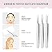 La Chat Blackhead Remover Tweezers - Pimple Popper Tool, 3 pcs Comedone Blackhead Extractor Tools for Blackhead, Pimple,Whitehead,Ance, Blemish