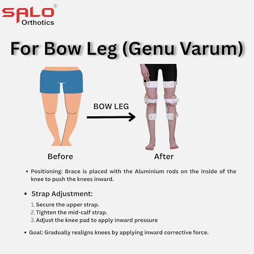 Image of SALO Orthotics Knock Knee & Bow Legs corrector - Genu Valgum Genu Varum Brace (SIZE -Pair of 19 inches)