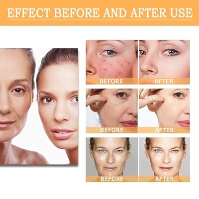 7% Glycolic Acid Exfoliating Toner, Gentle Exfoliating Toner, Smooth Skin, Restores Skin Vitality and Refreshing, Hydrating Formula, Pore Minimizer-240ml/8.44 fl.oz.