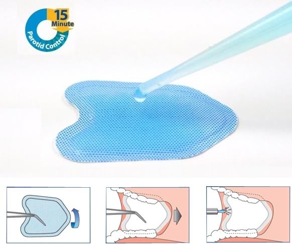 AmeriCan Goods 50/pk Dental Absorbent Pads Large Blue Saliva Absorbents N-Drys Reflective Pedo Moisture Control