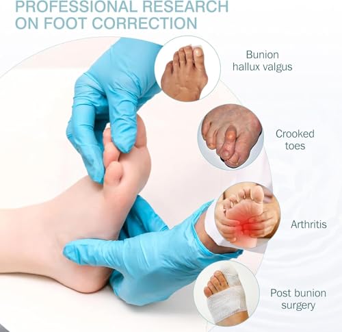 Image of Bunion Corrector Silicone Toe Separators For Fast Pain Relief - Orthopedic Bunion Spacers Spreader Free Size (Blue AFT)