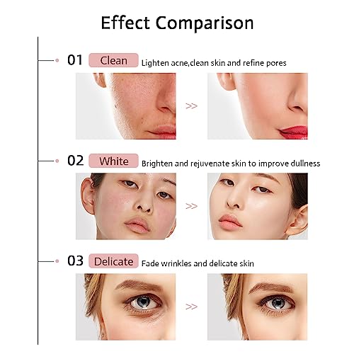 ENLIWISH LED Face Mask Light Therapy 3 Color Settings LED Mask Light Therapy - Anti Aging Red light - Skin Rejuvenation & Wrinkle Reduction - Soft & Lightweight - Portable... - Image 5