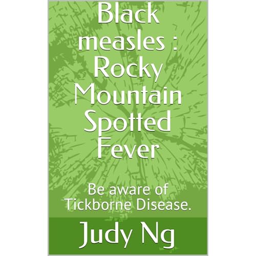 Black measles : Rocky Mountain Spotted Fever Audiolibro Por Judy Ng arte de portada