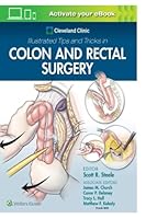 Colon and Rectal Surgery B0BJTSY8VB Book Cover