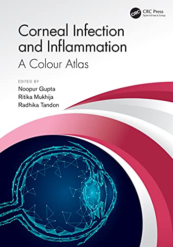 Corneal Infection and Inflammation: A Colour Atlas (English Edition) - Gupta, Noopur