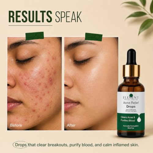 Image of The Element Acne Relief Drops - Drinkable Ayurvedic Skin Supplement | Neem, Turmeric & Shatavari with 19+ Herbs | No Artificial Sugar | For Breakouts & Clearer Skin | 30 ml (Pack of 1)