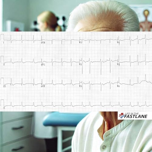 FREE RACGP KFP Exam Practice Question - 2025.1 KFP LS3Q1