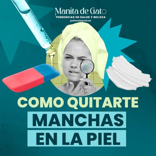 &iquest;Por qu&eacute; salen manchas en la piel? Todo sobre el melasma copertina