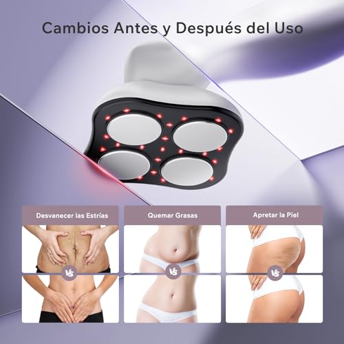 Masajeador Anticelulítico Profesional, 3 en 1 Masajeador Anticelulítico Eléctrico Unisex para Cintura, Vientre, Brazos, Glúteos y Piernas (Blanco) - imagen 4