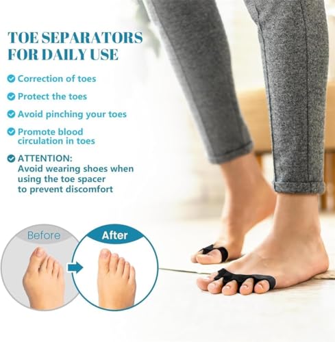 Image of Toe Separator for Feet Toe Spacers Correct Toes Yoga Silicone Hammer Toe Corrector for Women & Men Correct Toe Straighteners for Overlapping Toes (combo)