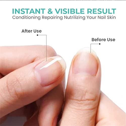 Augestpo 2023 Cc Rich Vitamin Nail Strengthening Cuticle Oil,Nail Oil Treatment For Damaged Nails,Cuticle Oil For Nails,Strengthens Nails Oil,Vitamin E Nail & Cuticle Oil (Orange) #TOP5