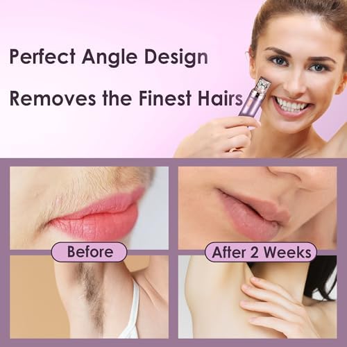 Gurelax Epilator for Women(2-in-1), Pluxy Facial Hair Remove, Epilation System, Precision tweezing Head, Soft Finish Styling, One-Touch Operation, All Ages and Skin Types — view 2