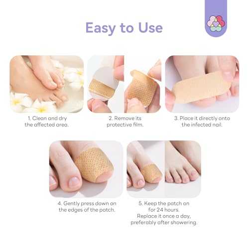 Image of SAVILAND Fungal Nail Patches 32 PCS FSA-HSA Extra Strength: 8H Overnight Repair 1% Tolnaftate Toenail Treatment Nighttime Nail Renewal Restores Damaged Nails Discolored Thick Yellow