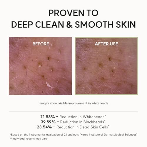 Arencia koreanischer Reis-Mochi-Gesichtsreiniger, schäumendes, sanftes Peeling, Alles-in-einem-Tiefenreinigung, feuchtigkeitsspendend, porenminimierend, entfernt Mitesser, 120 g