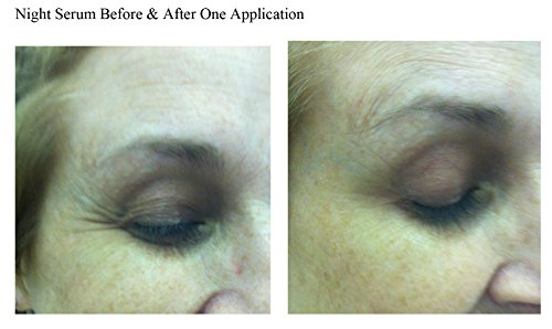 Age Defying Anti-Wrinkle Face & Eye Serum - Hyaluronic Acid Vitamin C And Retinol - Reduce Fine Lines, Dark Circles, Puffy Eyes - Love Your Skin Again! #TOP1