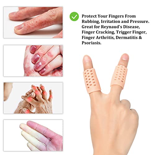 Gel Finger Cots (Breathable, Latex Free), Finger Protectors With Hole(14Pcs), Silicone Finger Gloves, Finger Covers For Hand Eczema, Trigger Finger, Finger Cracking, Finger Arthritis, Reusable. #TOP1