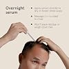 Keeps Everyday Scalp Refresh Serum - Nourishing & Exfoliating Scalp Treatment with Rosemary Oil, Caffeine & Salicylic Acid - Lightweight Leave-In Hair Serum for Men & Women - 2 Oz