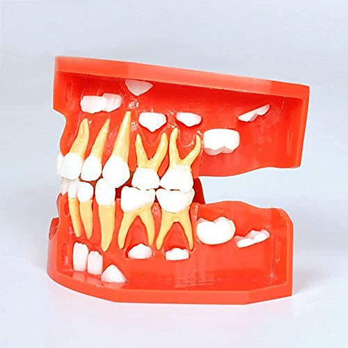Modèle dentaire d'apprentissage avec alternance de dents de lait et définitives